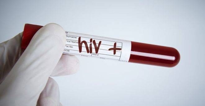 Tratamientos de VIH-Sida afectados por confinamiento por coronavirus