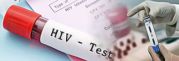 ¿Como puedo saber si tengo VIH / Sida?